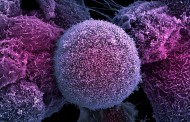 ژن‌های خودکشی کننده، درمانی جدید برای سرطان پروستات