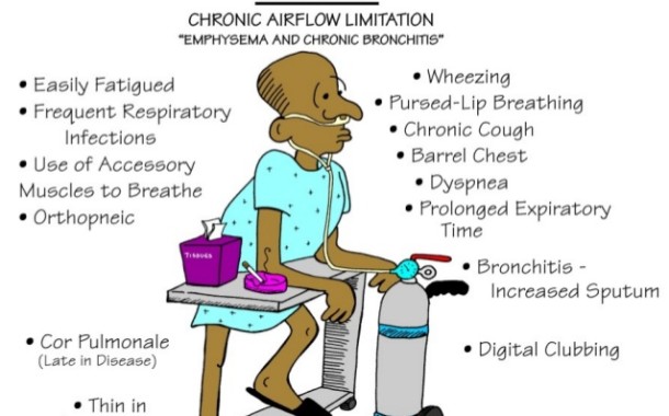 COPD (تصویر)